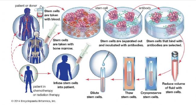 LABCONCO凍干機(jī)：冷凍保存技術(shù)在冷凍和儲(chǔ)存造血干細(xì)胞上的應(yīng)用